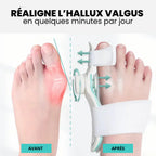 Correcteur Hallux Valgus Pro